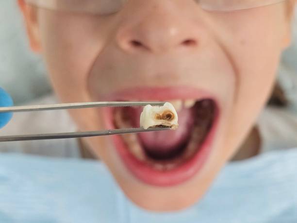 Best Dentist for Tooth Abscess  in New Johnsonville, TN